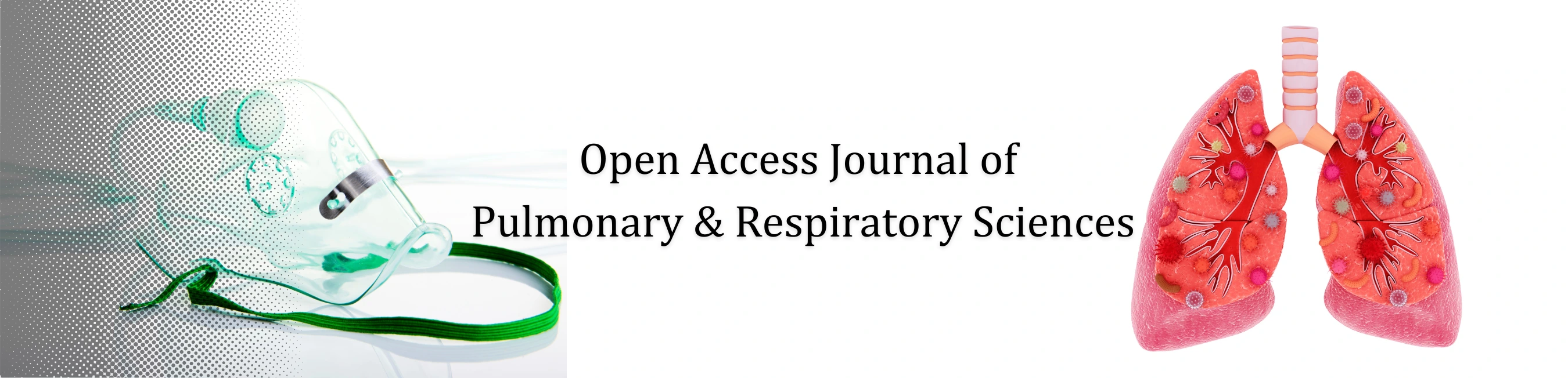 Banner Image of Open Access Journal of Pulmonary & Respiratory Sciences